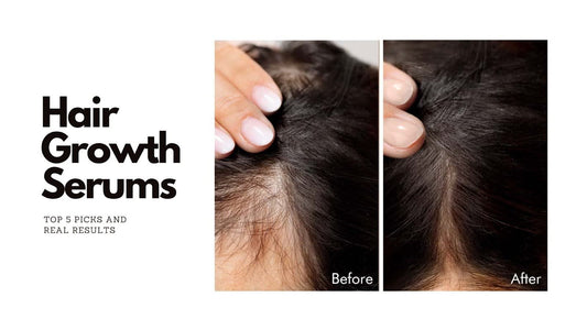 Top 5 Hair Growth Serums In India To Pick